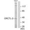 Solute carrier family 22 member 18 antibody, A06197, Boster Biological Technology, Western Blot image 