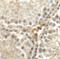 Meiosis/Spermiogenesis Associated 1 antibody, A16264, Boster Biological Technology, Immunohistochemistry paraffin image 