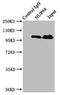 Nucleoporin 98 antibody, CSB-PA016209LA01HU, Cusabio, Immunoprecipitation image 