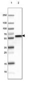 Glutamate Decarboxylase 2 antibody, NBP2-46629, Novus Biologicals, Western Blot image 