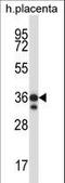 STK26 antibody, LS-C164491, Lifespan Biosciences, Western Blot image 
