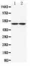 Tryptophan Hydroxylase 1 antibody, MA1099, Boster Biological Technology, Western Blot image 