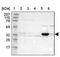 Dehydrogenase/Reductase 1 antibody, PA5-51420, Invitrogen Antibodies, Western Blot image 