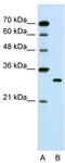 Ribosome maturation protein SBDS antibody, TA338056, Origene, Western Blot image 