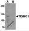 T Cell Immune Regulator 1, ATPase H+ Transporting V0 Subunit A3 antibody, 6973, ProSci, Western Blot image 