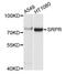 SRP Receptor Subunit Alpha antibody, A5939, ABclonal Technology, Western Blot image 