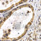 Heat shock protein beta-8 antibody, A2514, ABclonal Technology, Immunohistochemistry paraffin image 