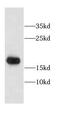 Calmodulin-like protein 3 antibody, FNab01204, FineTest, Western Blot image 