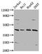 SPO11 Initiator Of Meiotic Double Stranded Breaks antibody, LS-C681446, Lifespan Biosciences, Western Blot image 