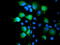 Sentrin-specific protease 2 antibody, LS-C788649, Lifespan Biosciences, Immunofluorescence image 