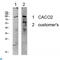 Potassium Voltage-Gated Channel Subfamily B Member 1 antibody, LS-C813447, Lifespan Biosciences, Western Blot image 