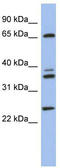 V-type proton ATPase catalytic subunit A antibody, TA337648, Origene, Western Blot image 