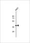 N-Myc And STAT Interactor antibody, M02768-1, Boster Biological Technology, Western Blot image 