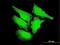 Calcium/Calmodulin Dependent Protein Kinase II Delta antibody, H00000817-M04, Novus Biologicals, Immunocytochemistry image 