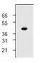 C-C Motif Chemokine Receptor 1 antibody, AP00156PU-N, Origene, Western Blot image 