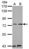 Pumilio RNA Binding Family Member 3 antibody, NBP2-17042, Novus Biologicals, Western Blot image 