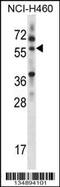 Multiple inositol polyphosphate phosphatase 1 antibody, 57-939, ProSci, Western Blot image 