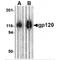 Retrovirus-related Env polyprotein from Fv-4 locus antibody, TA160083, Origene, Western Blot image 