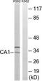 CA1 antibody, TA313537, Origene, Western Blot image 