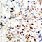 RB Binding Protein 8, Endonuclease antibody, LS-C368496, Lifespan Biosciences, Immunohistochemistry frozen image 