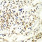 UPF1 RNA Helicase And ATPase antibody, LS-C335164, Lifespan Biosciences, Immunohistochemistry paraffin image 
