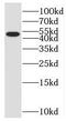 SMU1 DNA Replication Regulator And Spliceosomal Factor antibody, FNab08045, FineTest, Western Blot image 