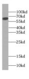 Carboxypeptidase A6 antibody, FNab01264, FineTest, Western Blot image 