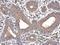ATPase Sarcoplasmic/Endoplasmic Reticulum Ca2+ Transporting 3 antibody, GTX102381, GeneTex, Immunohistochemistry paraffin image 
