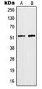 Heterogeneous Nuclear Ribonucleoprotein F antibody, orb214043, Biorbyt, Western Blot image 