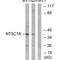 5'-Nucleotidase, Cytosolic IA antibody, A12036, Boster Biological Technology, Western Blot image 