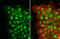 Tumor Protein P63 antibody, GTX635841, GeneTex, Immunocytochemistry image 
