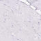 Major Histocompatibility Complex, Class II, DR Alpha antibody, HPA053176, Atlas Antibodies, Immunohistochemistry paraffin image 