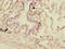 Decapping MRNA 1A antibody, LS-C675622, Lifespan Biosciences, Immunohistochemistry paraffin image 