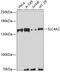 Solute Carrier Family 4 Member 2 antibody, 23-137, ProSci, Western Blot image 