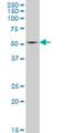Heat Shock Transcription Factor 4 antibody, H00003299-M03, Novus Biologicals, Western Blot image 