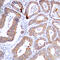 Mitogen-Activated Protein Kinase Kinase 1 antibody, LS-C354252, Lifespan Biosciences, Immunohistochemistry frozen image 