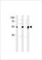 DMRT Like Family A2 antibody, TA324686, Origene, Western Blot image 