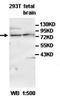 Zinc Finger CCHC-Type Containing 7 antibody, orb77745, Biorbyt, Western Blot image 