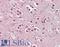 Cholinergic Receptor Nicotinic Beta 2 Subunit antibody, LS-B8300, Lifespan Biosciences, Immunohistochemistry frozen image 