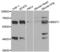Bestrophin-1 antibody, abx004386, Abbexa, Western Blot image 