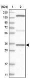 Chromosome 8 Open Reading Frame 48 antibody, NBP1-93919, Novus Biologicals, Western Blot image 