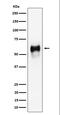 CD58 Molecule antibody, M02800, Boster Biological Technology, Western Blot image 