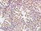 Beclin 1-associated autophagy-related key regulator antibody, orb182430, Biorbyt, Immunohistochemistry paraffin image 