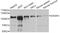 EWS RNA Binding Protein 1 antibody, STJ27922, St John