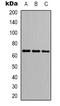 p68 antibody, orb339203, Biorbyt, Western Blot image 