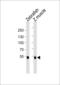 Sterol Regulatory Element Binding Transcription Factor 2 antibody, MBS9201316, MyBioSource, Western Blot image 