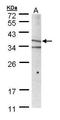 MHC Class I Polypeptide-Related Sequence A antibody, GTX105052, GeneTex, Western Blot image 