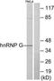 Heterogeneous nuclear ribonucleoprotein G antibody, TA311681, Origene, Western Blot image 