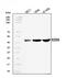 Branched Chain Keto Acid Dehydrogenase E1 Subunit Alpha antibody, A04561-1, Boster Biological Technology, Western Blot image 