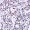Lamin A/C antibody, orb74158, Biorbyt, Immunohistochemistry paraffin image 